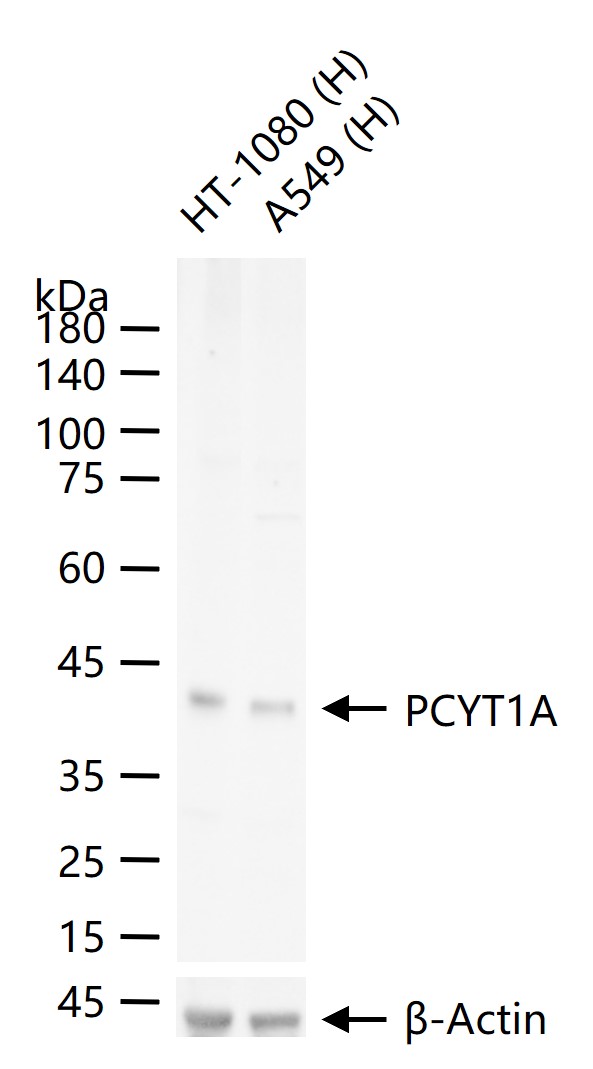 磷酸乙醇胺转移酶A重组兔单抗
