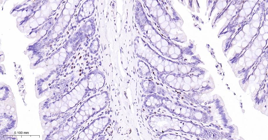 肌细胞增强因子2C重组兔单抗