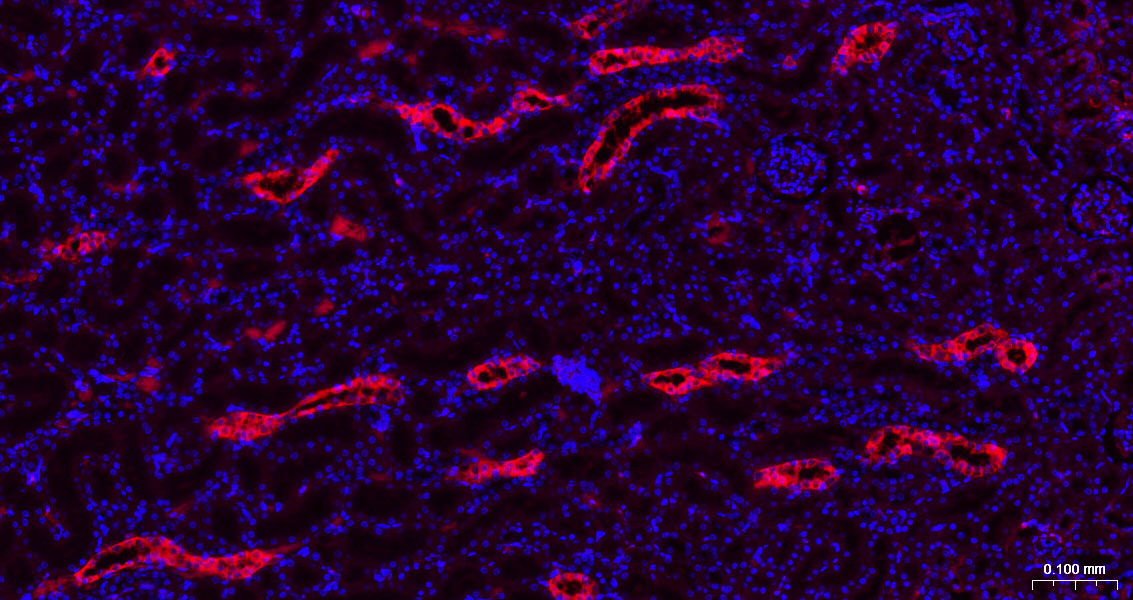 半乳糖凝集素3抗体-bs-41218R