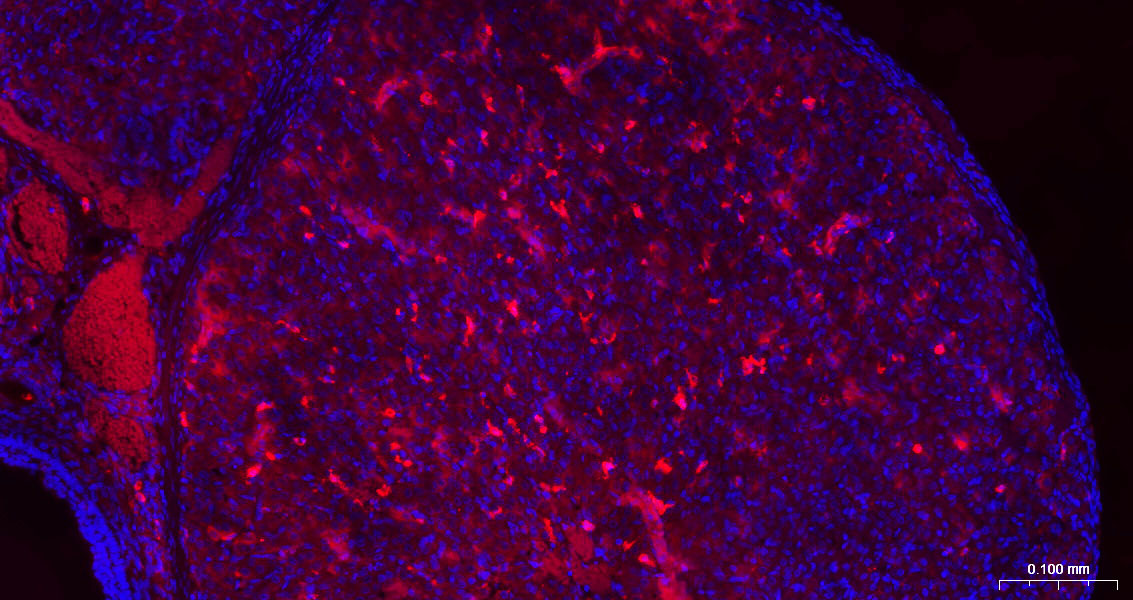 半乳糖凝集素3抗体-bs-41218R