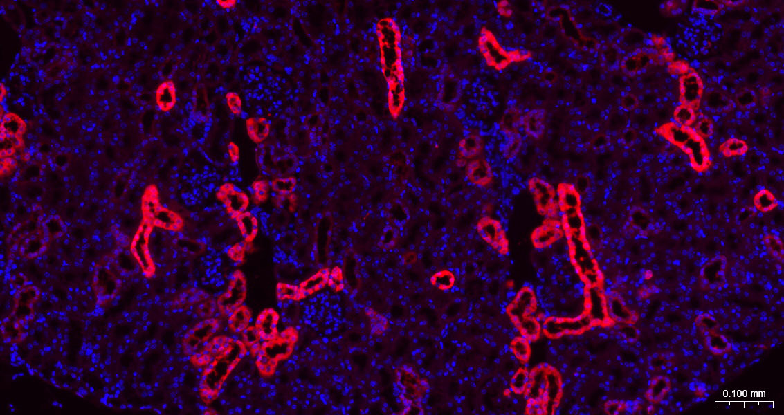 半乳糖凝集素3抗体-bs-41218R