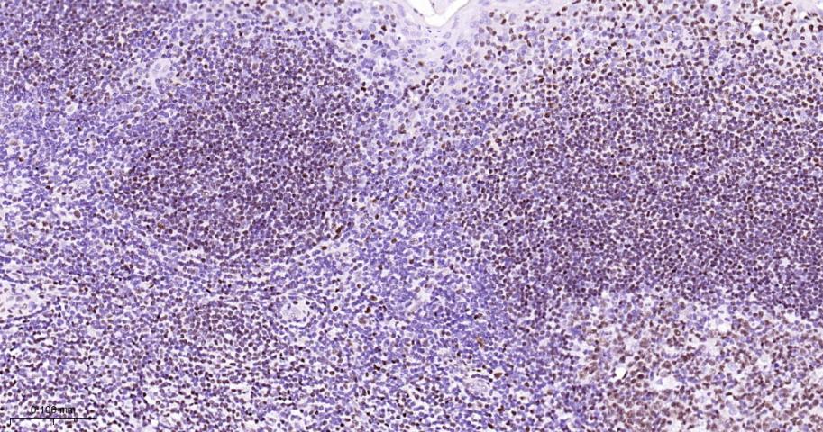 肌细胞增强因子2C重组兔单抗