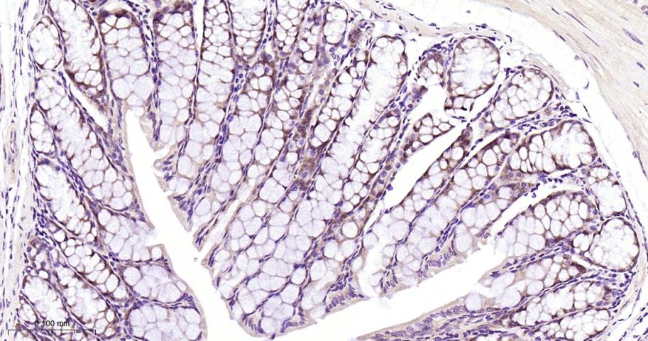 Smad4重组兔单抗