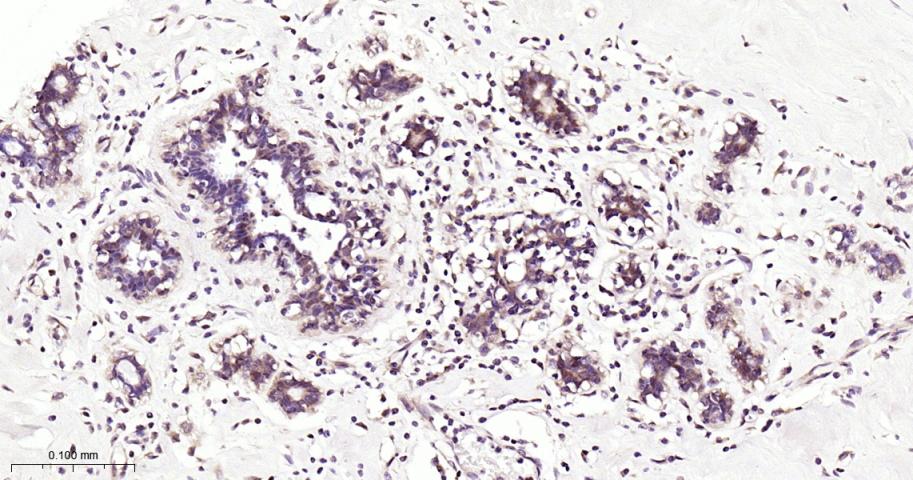 Smad4重组兔单抗