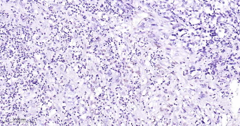 肌细胞增强因子2C重组兔单抗