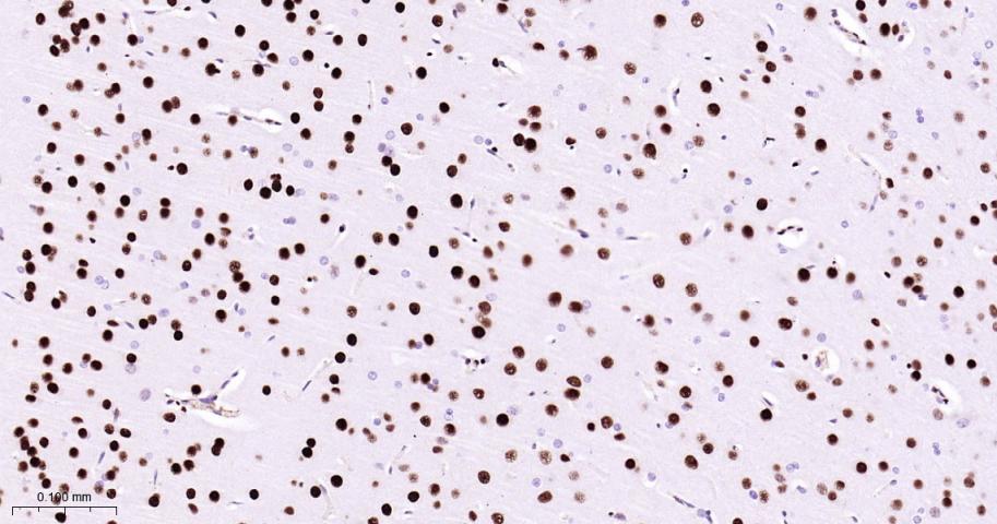 肌细胞增强因子2C重组兔单抗