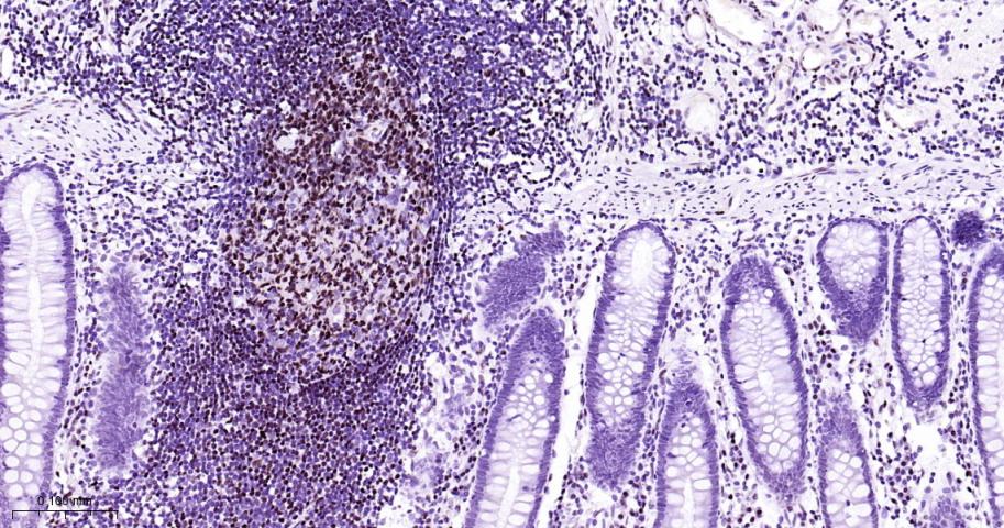 肌细胞增强因子2C重组兔单抗