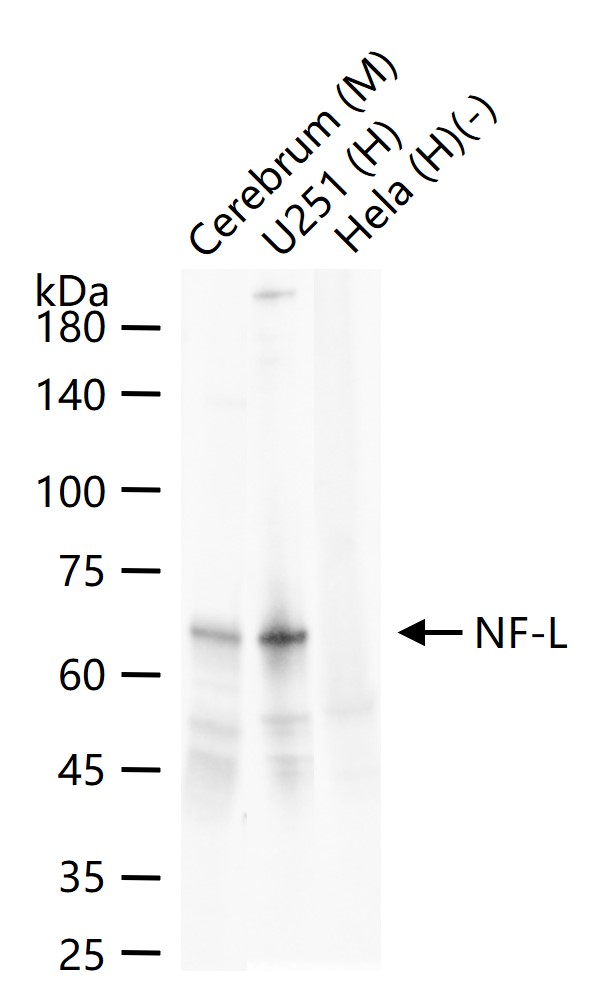 低分子量神经丝蛋白重组兔单抗