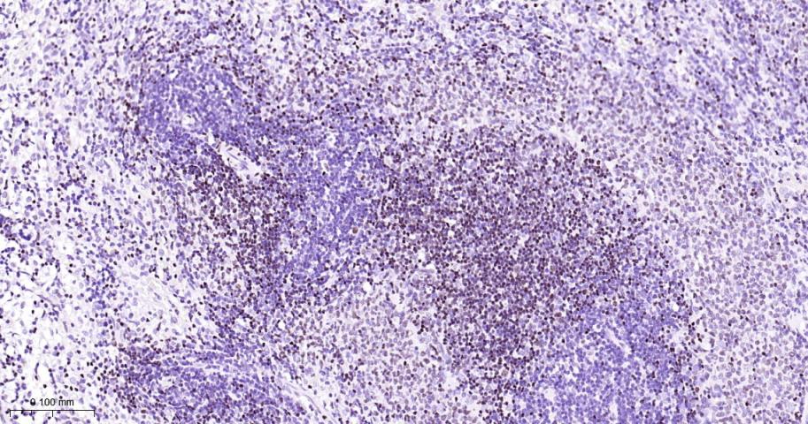 肌细胞增强因子2C重组兔单抗