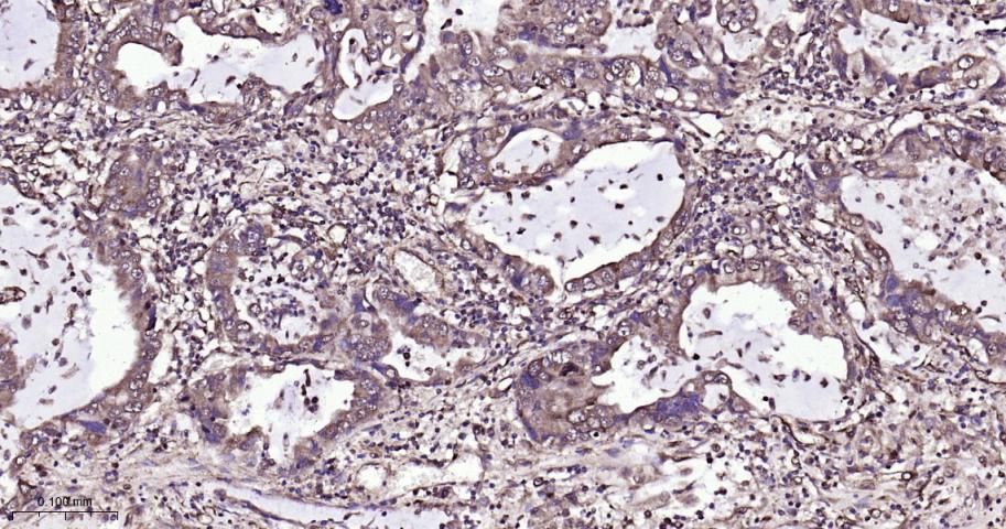 有丝分裂激酶A与重组兔单抗