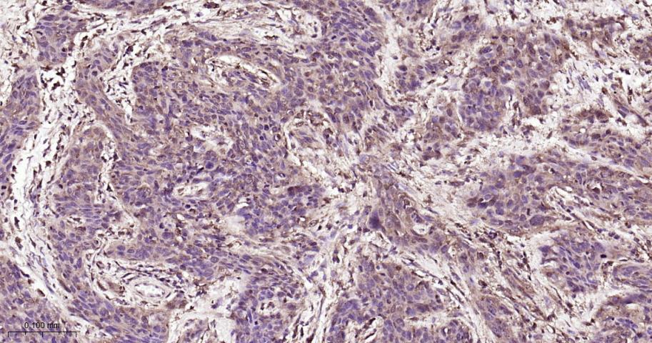 有丝分裂激酶A与重组兔单抗