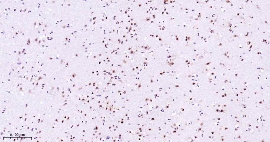 肌细胞增强因子2C重组兔单抗