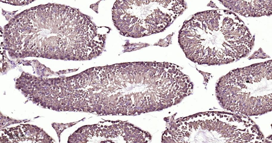 有丝分裂激酶A与重组兔单抗