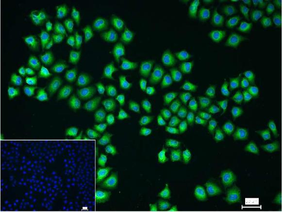 细胞核因子/k基因结合核因子抗体-bs-0465R