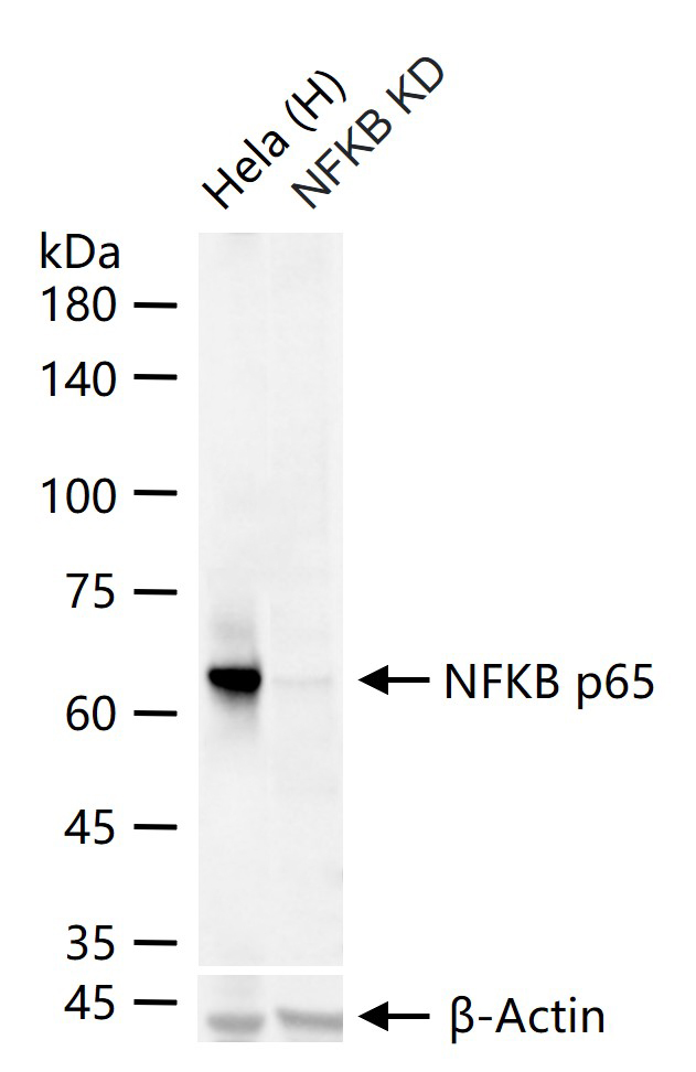 细胞核因子/k基因结合核因子重组兔单抗