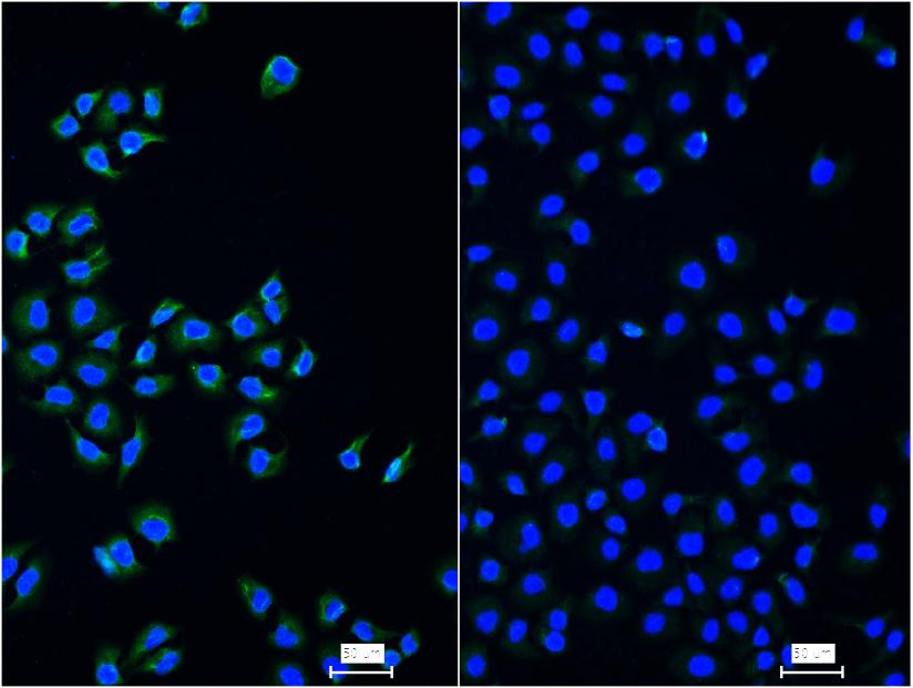 细胞核因子/k基因结合核因子重组兔单抗