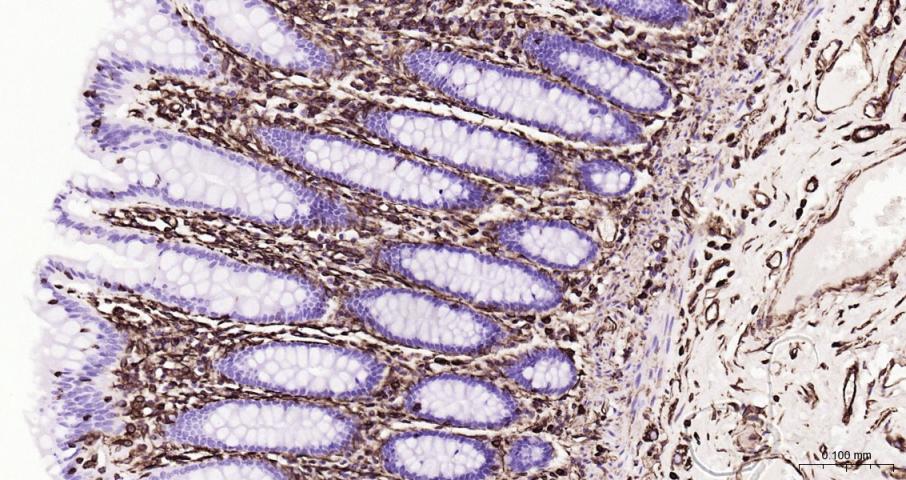 超敏二步法免疫组化检测试剂盒(即用型)(兔鼠通用)-PV-1025
