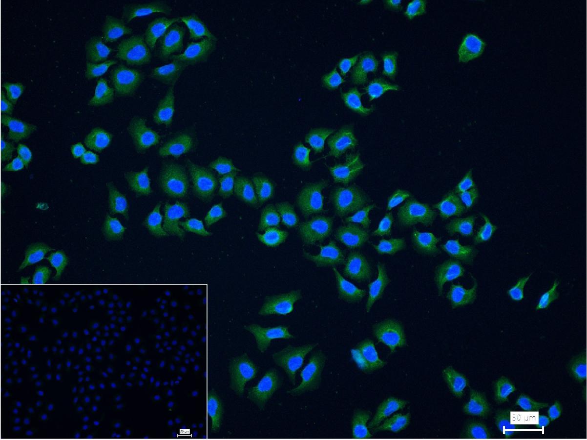 细胞核因子/k基因结合核因子抗体-bs-20160R