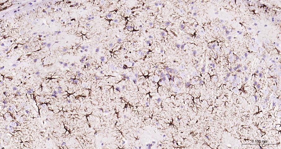 超敏二步法免疫组化检测试剂盒(即用型)(兔鼠通用)-PV-1025