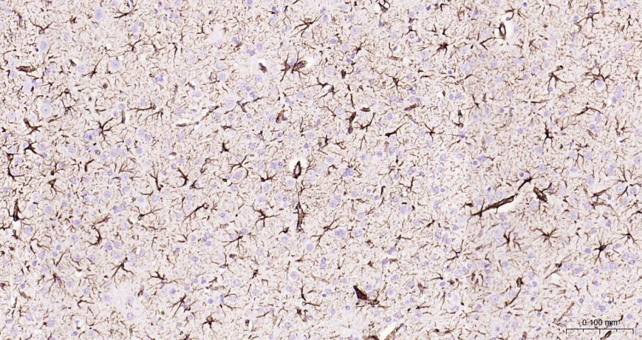 超敏二步法免疫组化检测试剂盒(即用型)(兔鼠通用)-PV-1025