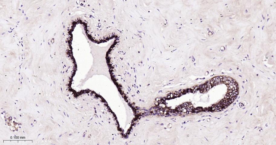 肿瘤相关钙信号传感器2重组兔单抗