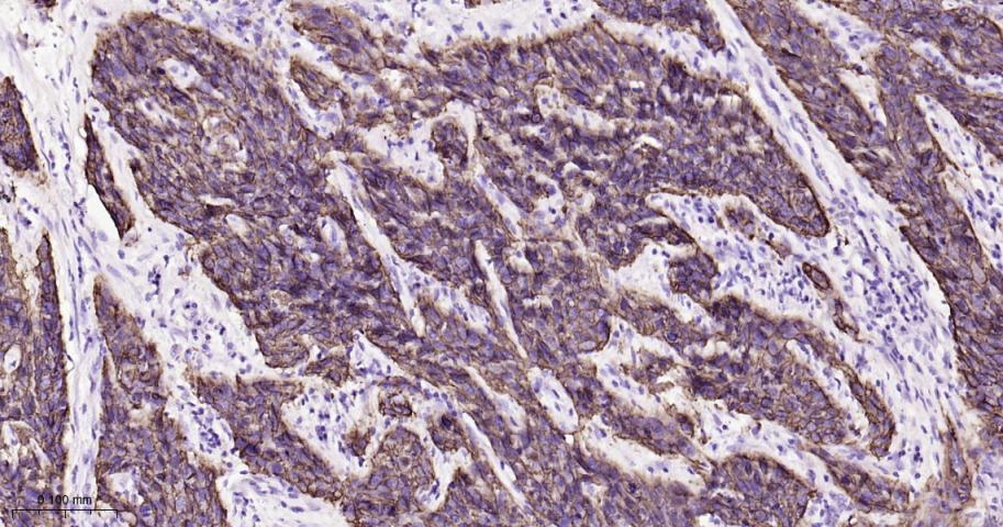 肿瘤相关钙信号传感器2重组兔单抗