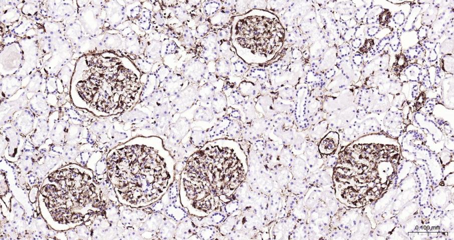 超敏二步法免疫组化检测试剂盒(即用型)(兔鼠通用)-PV-1025