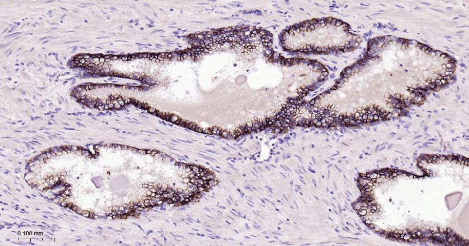 肿瘤相关钙信号传感器2重组兔单抗