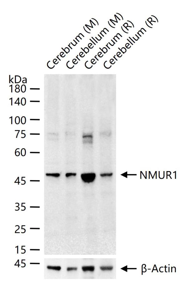 NMUR1 Rabbit pAb (一抗) - WB | Bioss