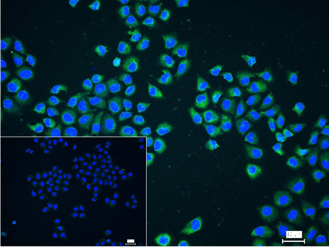 细胞核因子/k基因结合核因子重组兔单抗