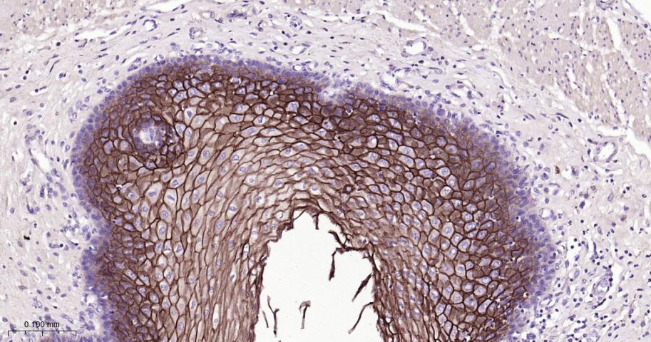 肿瘤相关钙信号传感器2重组兔单抗
