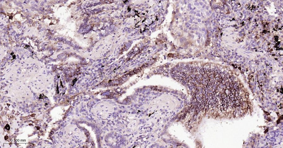 肿瘤相关钙信号传感器2重组兔单抗
