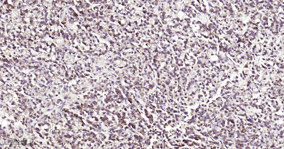 自噬相关蛋白12重组兔单抗-bsm-61199R