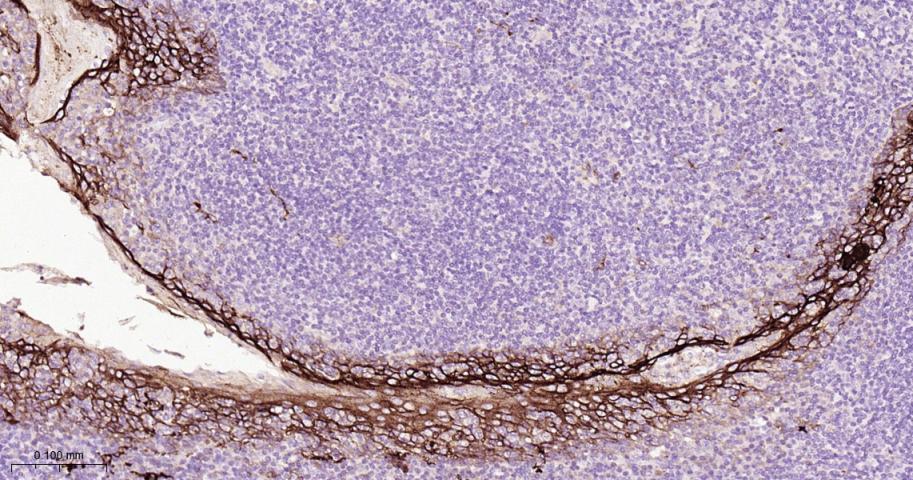 肿瘤相关钙信号传感器2重组兔单抗