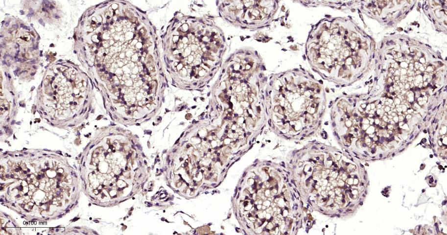 自噬相关蛋白12重组兔单抗-bsm-61199R