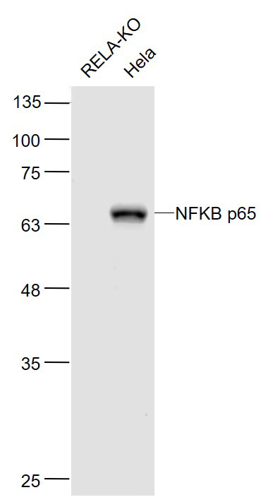 NFKB p65 Mouse mAb (一抗) - WB,IHC-P,IHC-F,IF,ICC/IF | Bioss