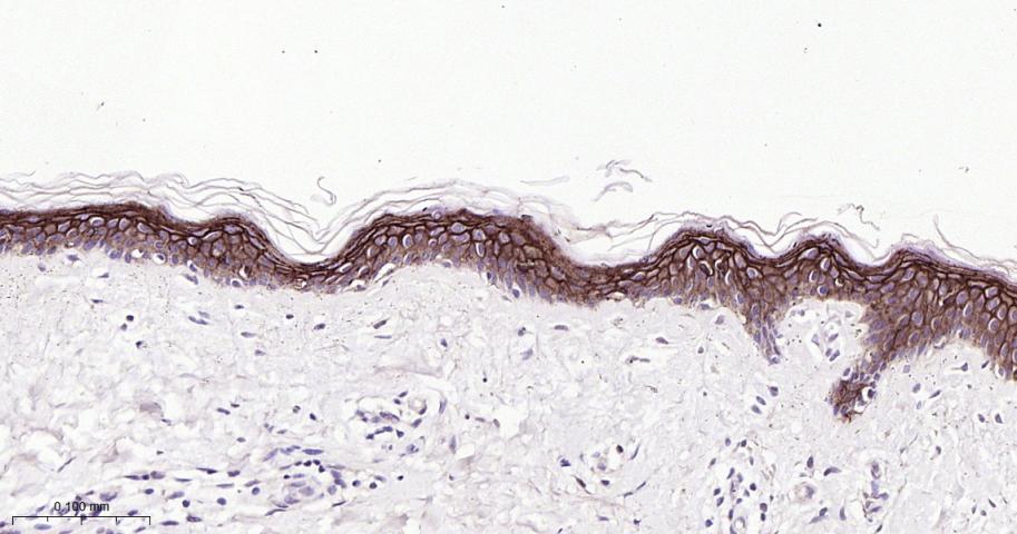 肿瘤相关钙信号传感器2重组兔单抗