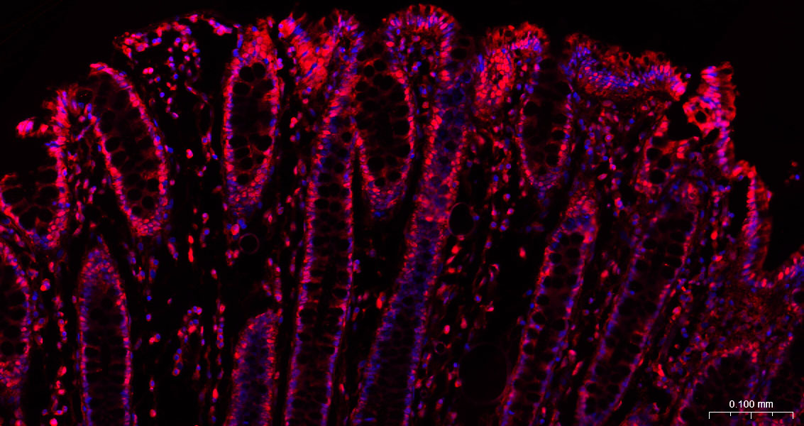 3-磷酸甘油醛脱氢酶(内参)抗体