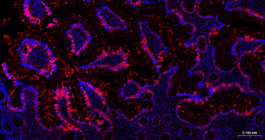 半乳糖凝集素3抗体-bs-41218R