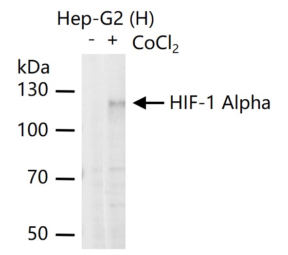 缺氧诱导因子1α 单克隆抗体-bsm-33428M