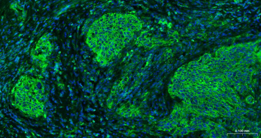 钠钾ATP酶蛋白a1单克隆抗体-bsm-34014M