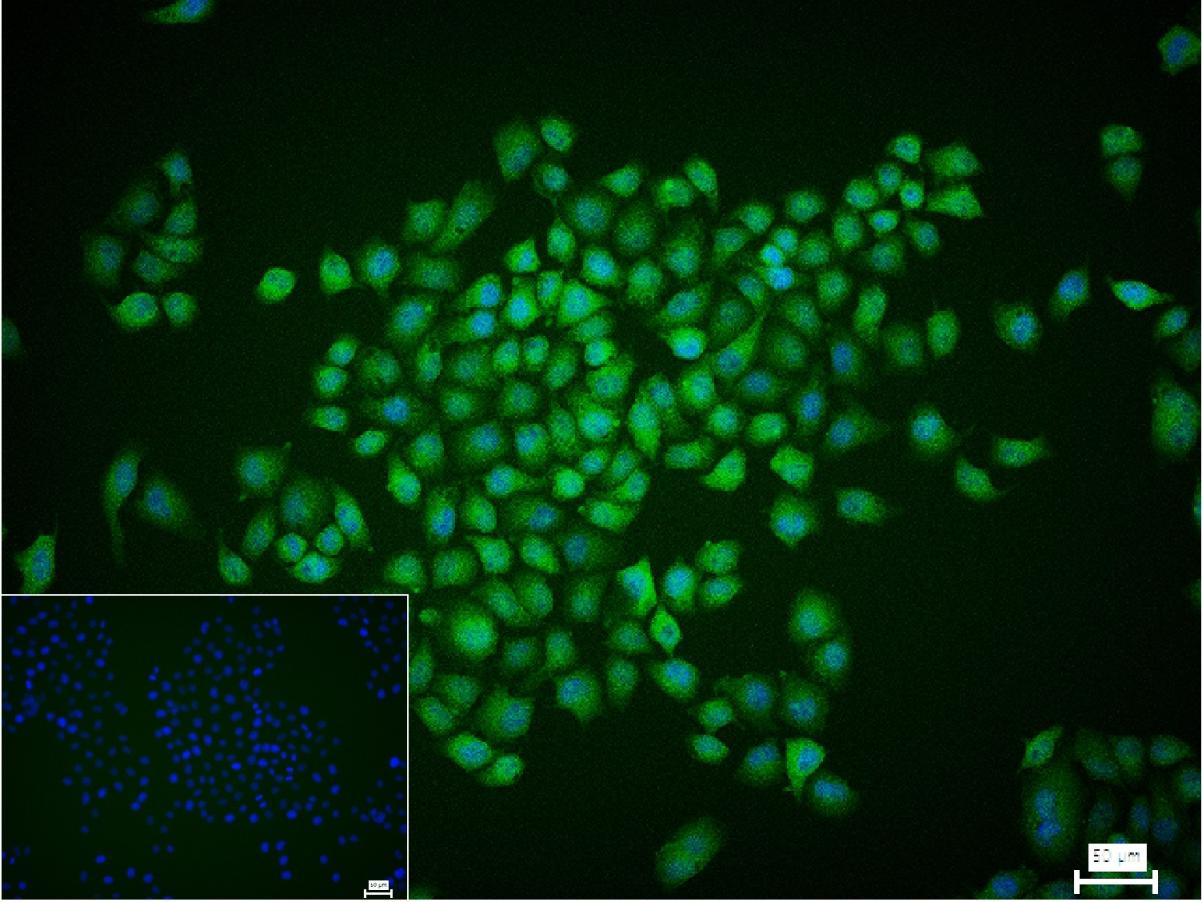 p38 MAPK重组兔单抗
