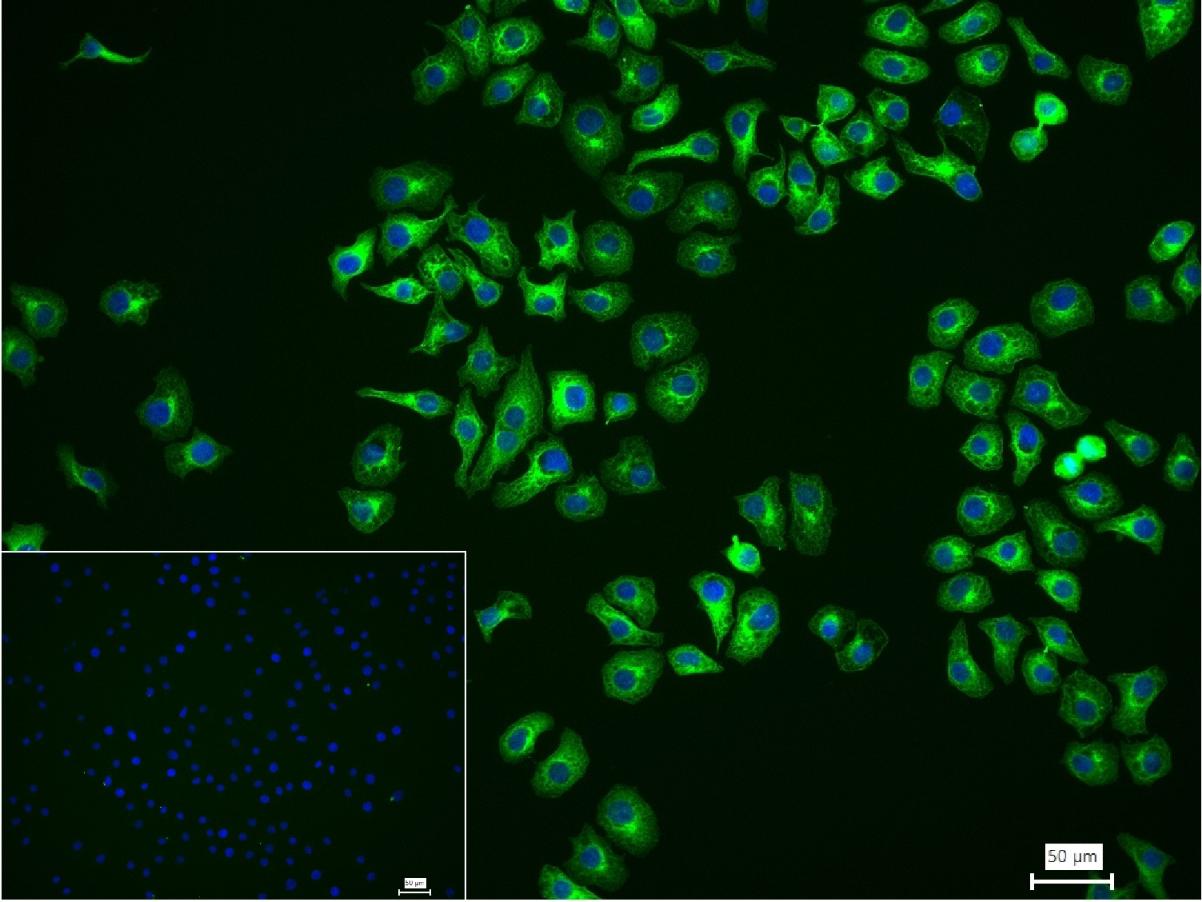 微管蛋白β1 tubulin(内参)重组兔单抗