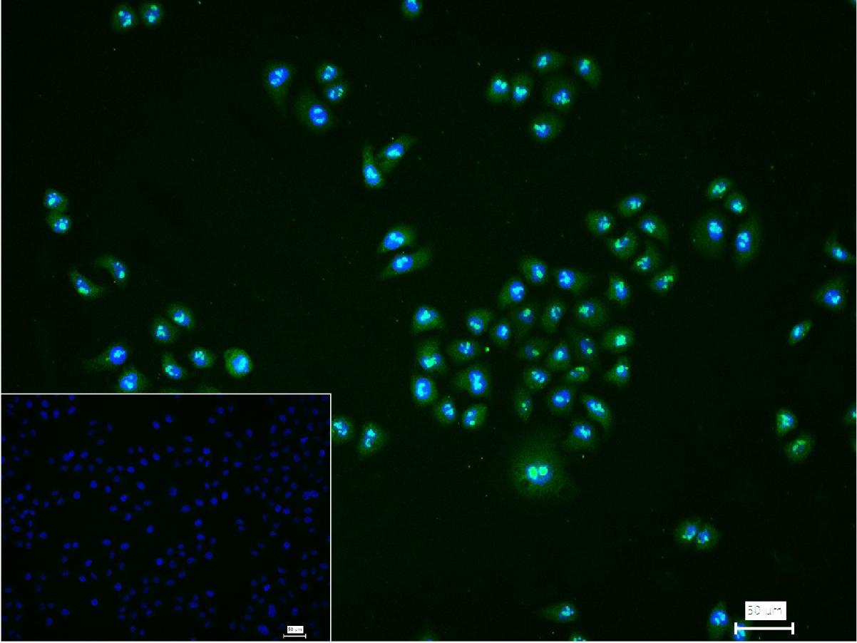 组蛋白去甲基化酶JARID1A重组兔单抗