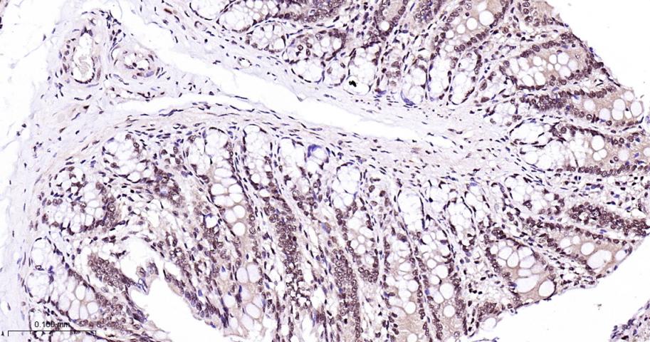 丝裂原活化蛋白激酶p38α重组兔单抗