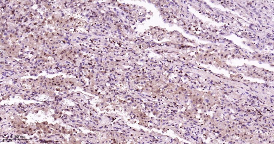 p38 MAPK重组兔单抗