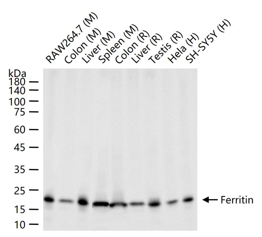 铁蛋白重组兔单抗