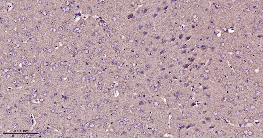 等电压依赖性阴离子通道（内参）重组兔单抗