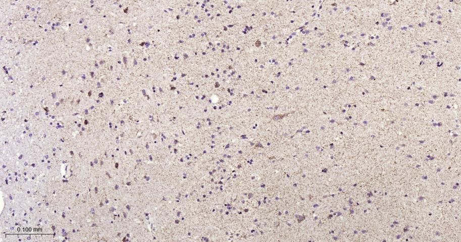 铁调节蛋白2重组兔单抗