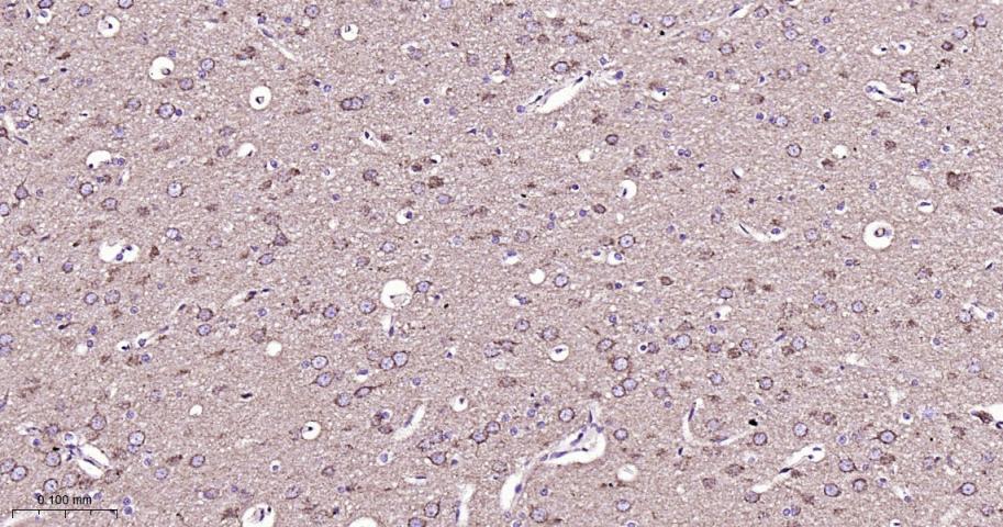 等电压依赖性阴离子通道（内参）重组兔单抗